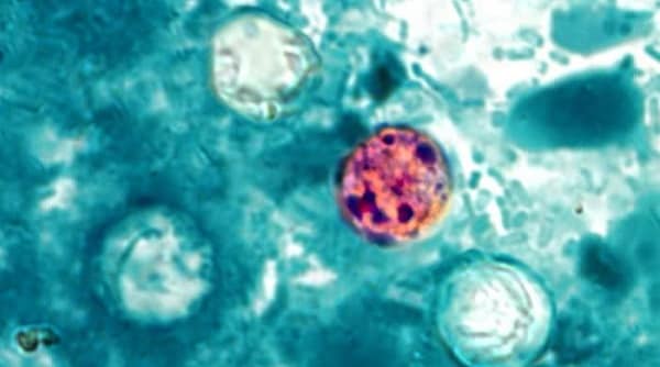 Cyclospora-parasite-modified-acidfast-stain