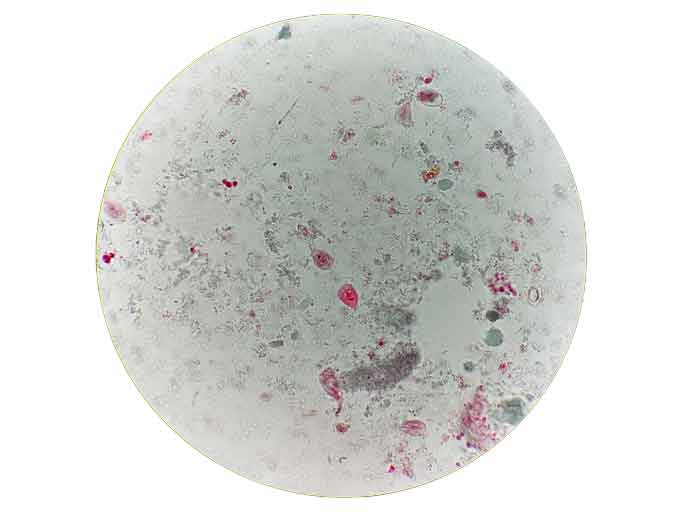 Giardia-trophozite-stain-Web